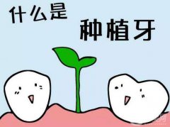 上海種植牙醫(yī)院信息介紹呢?