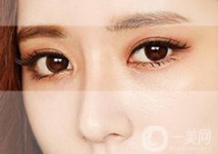 *術(shù)后注意事項有哪些？