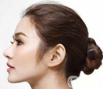 隆鼻能保持一輩子嗎？