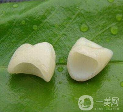 金鈀合金烤瓷牙價(jià)格多少錢？
