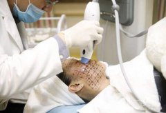 熱瑪吉緊膚除皺價(jià)格多少錢？