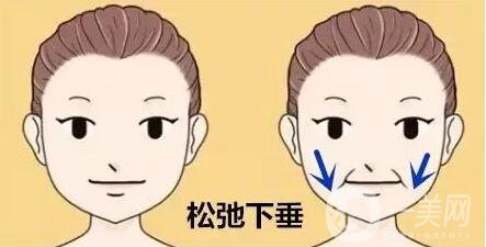 去法令紋,方式