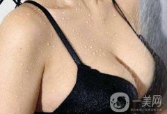 北京妙姚假體隆胸需要多少錢?