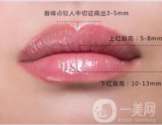 廣東玻尿酸豐唇價(jià)錢是多少?