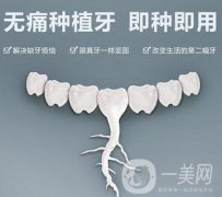 上海人工種植牙價格是多少呢?