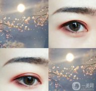 割雙眼皮有后遺癥嗎?上海割雙眼皮后遺癥有哪些?