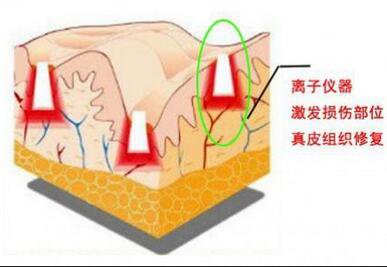 上海做一次像素激光去疤痕手術(shù)調(diào)節(jié)多少錢