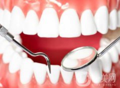 上海鈷鉻烤瓷牙價格一般是多少錢