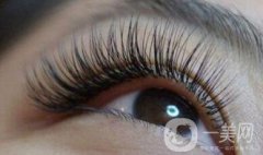 深圳移植睫毛大概多少錢？術(shù)后注意事項有哪些