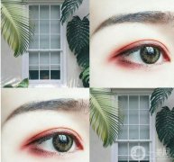 成都割雙眼皮介紹？