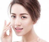 面部吸脂和去頰脂墊信息介紹