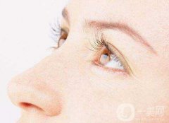 埋線雙眼皮5天能消腫嗎？
