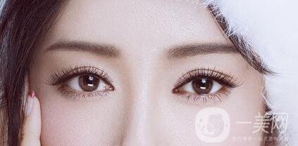 全切雙眼皮多久恢復？