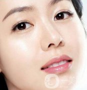 開(kāi)內(nèi)眼角多久恢復(fù)自然？