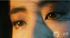 北京割雙眼皮介紹