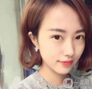 雙眼皮手術拆線后要怎樣護理