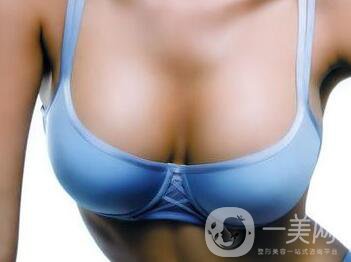 硅膠隆胸能管多久？隆胸手術(shù)具體費用