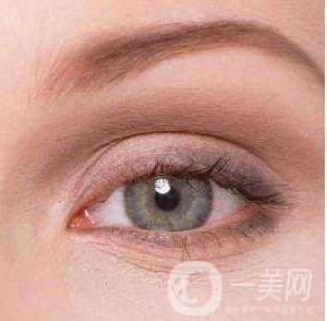 割雙眼皮,割雙眼皮恢復(fù)時(shí)間