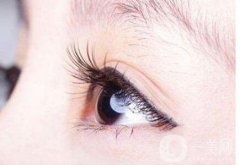 睫毛移植有哪些后遺癥呢?