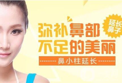 鼻小柱延長,鼻小柱延長費用,廣東鼻小柱延長費用