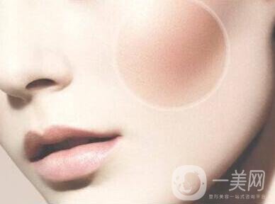 顴骨手術(shù)多長時間恢復？
