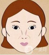 北京顴骨降低手術(shù)大概需要多少錢