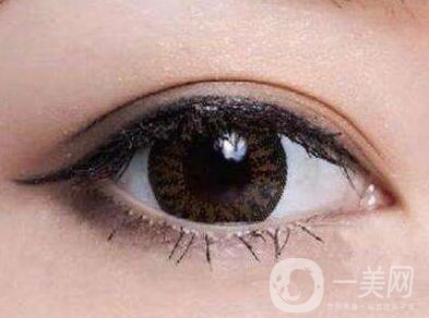 上海開眼角手術的費用是多少？