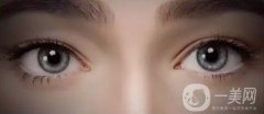 開(kāi)眼角手術(shù)價(jià)格是多少？