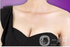 成都假體豐胸的價(jià)格