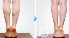 廣州注射注射瘦腿一針多少錢