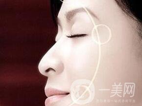 電波拉皮去除抬頭紋*果怎樣？
