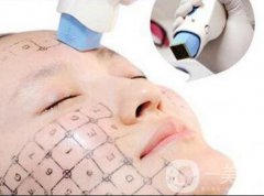 熱瑪吉與電波拉皮手術(shù)的區(qū)別有些什么