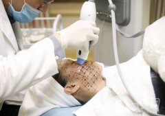 北京整形熱瑪吉拉皮價格要多少錢？