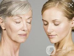 拉皮*嗎？有沒有風(fēng)險(xiǎn)呢？