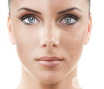 熱瑪吉有什么果 果怎么樣