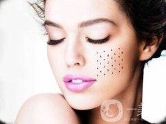 熱瑪吉緊膚多少錢？