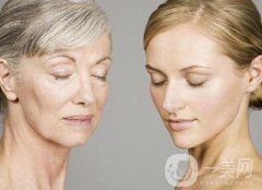 成都電波拉皮一次多少錢