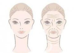 深圳*去眉間紋要多少錢?注意事項(xiàng)有哪些？