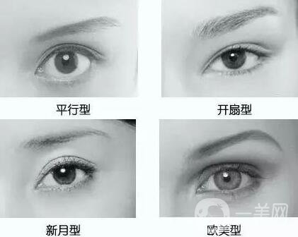 做韓式*雙眼皮術(shù)的優(yōu)點(diǎn)有哪些？