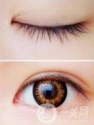 開完眼角怎么預防增生？