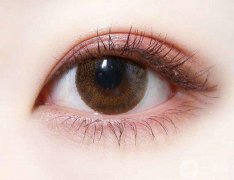 割雙眼皮后可以維持多久呢?割雙眼皮多久恢復(fù)呢?