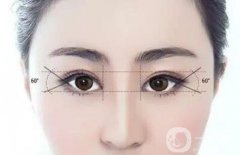 上海開眼角修復介紹？多少錢呢？