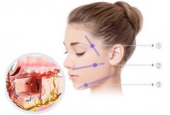 深藍射頻和熱瑪吉有哪些區(qū)別呢?深藍射頻和熱瑪吉那個好?