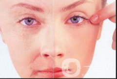 來例假可否做熱瑪吉呢?做熱瑪吉多少錢？