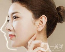 肋骨隆鼻多久可以修復？