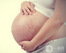 成都腹壁整形去妊娠紋多少錢呢？術(shù)后怎么護(hù)理？