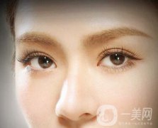 做了埋線多久能恢復自然？