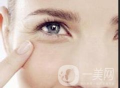 玻尿酸去魚尾紋果好嗎