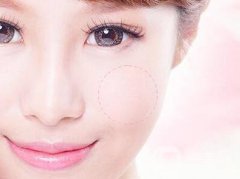 磨顴骨后遺癥有哪些？術(shù)后如何護(hù)理？