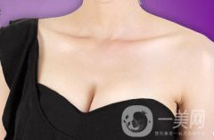 做假體豐胸手術(shù)影響生育嗎